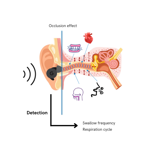 Detection of swallowing and breathing using an in-ear microphone  image